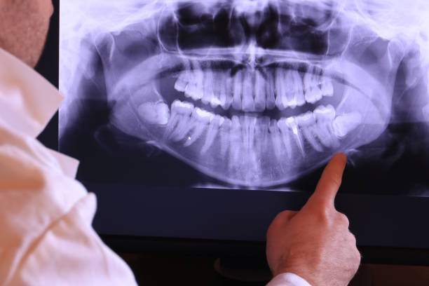 Best Emergency Tooth Extraction in East Rutherford, NJ