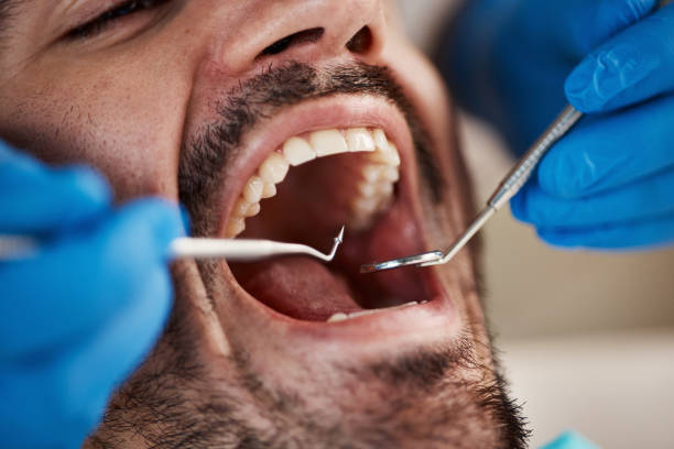 Best Emergency Treatment for Dental Infections or Abscesses in East Rutherford, NJ