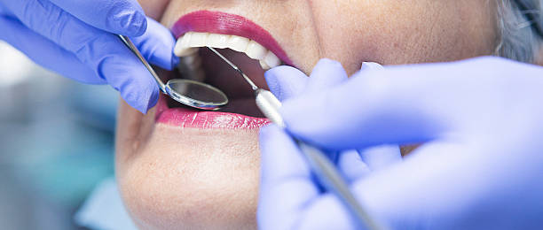 Best Emergency Dental Care for Broken or Chipped Teeth in East Rutherford, NJ